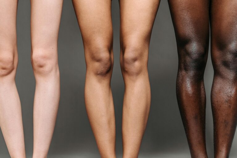 Crafting the Perfect Blog Structure: A Guide for Effective Blogging 3 Close-up of diverse women's legs showcasing different skin tones, emphasizing inclusivity and beauty.